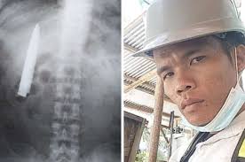Download the perfect filipino man pictures. Filipino Man Shocked To Find 10cm Blade In Chest During Regular Medical Examination News Rojak Daily