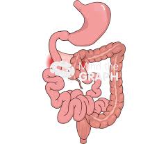 Image result for Intestinal Malrotation