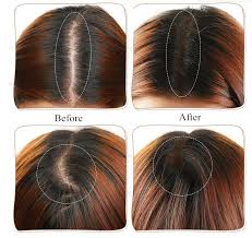 Hide the fact that your hair is thinning by ensuring your head is fully covered. 38 Best Color For Thin Hair Color Thin Hair