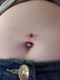 Help Please I Was Wondering If I Should Let My Navel Do Its Thing Or If I Should Take It Out And Re Pierce It Later If I Re Pierce Will They