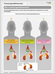 Image result for Hyperaldosteronism