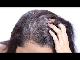 Top 10 home remedies to prevent grey hair. Here S An Amazing Home Remedy That Will Help You Reverse Your Hair Graying And Turn Them Black Again Reverse Gray Hair Grey Hair Home Remedies Grey White Hair
