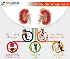 Kidney Stones Are Sometimes Left Unnoticed Know These Symptoms For You And Your Family Get Yourself Kidney Stones Health Care For All Kidney Stones Symptoms