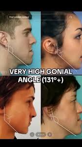 images?q=tbn:ANd9GcQ86SksHLehiJrCdDKipPu5t_RXKyQiINpAiw&s