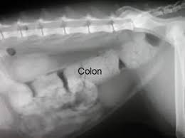 Image result for Megacolon