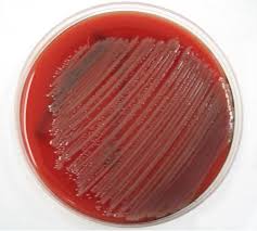 Resultado de imagen para Pseudomonas aeruginosa