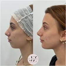 Conocíais nuestro servicio de Control del peso? 🤩 El Dr. Efraín Cordero,  endocrinólogo, nos cuenta más sobre el control ponderal ❤️ 📉 Mantener un  peso saludable no solo se trata de la