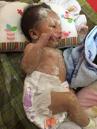 Baiklah daripada penasaran lebih baik langsung saja kita. Petua Turunkan Kuning Baby Sy Pakar Borong Barang Baby Facebook