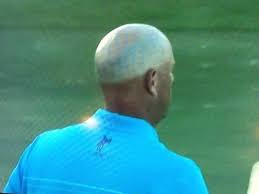 All throughout today chasing him, i was like, 'i cannot let stewart cink beat another kansas city golfer.' but now that it's over with. Stewart Cink Has A Horrifying Tan Line On His Head