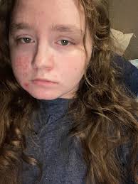 Prayers for Destiny's upcoming pacemaker surgery and recovery