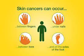 Subungual melanomas usually appear as a brown or black streak under the nail. Abcde Melanoma Self Check Method Complete Overview
