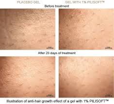 At that time, the hairs with the length of ¼ of an inch, will get away quite easily. Leg Waxing Hair Length