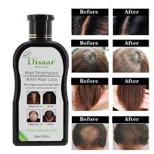 Check out these easy black hair care tips that will help you get longer, stronger and healthier hair. Professional Hair Growth Shampoo Preventing Hair Loss Chinese Hair Regrowth Product Hair Treatment For Men Women Black Hair Dye Men S Hair Loss Products Aliexpress