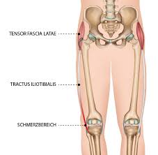 Tractus Syndrom Dr Matthias Marquardt