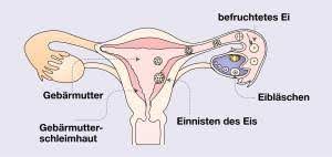 Eine schwangerschaft außerhalb der gebärmutter kann darüber hinaus lebensgefährlich sein. Ein Kind Entsteht Ellviva