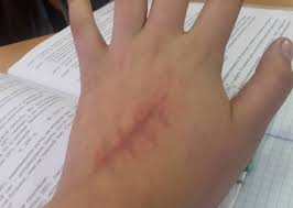 Image result for samoubistvo