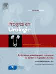 Radioth rapie st r otaxique biochimique 3 ans tait m diocre 78 mais la prostate cancer. Dysfonctions Sexuelles Apres Curietherapie Et Radiotherapie Externe De La Prostate Pour Cancer De La Prostate Localise Sciencedirect