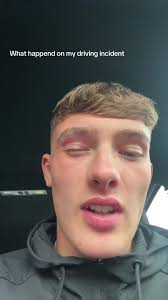 Car Accident Mason and Roscoe