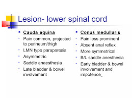 Image result for Neurologic Lesion Localization