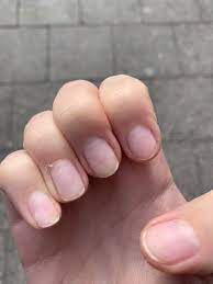 Shellac ist eine harzige substanz, die aus den ausscheidungen der lackschildlaus nach ihrem saugen an bestimmten pflanzen gewonnen wird. Was Du Uber Eine Shellac Manikure Wissen Musst Morgen Wird Gestern
