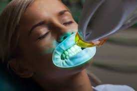 Image result for Teeth Whitening