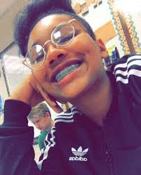 My Pinѕ Are Tne ѕnit ѕparĸlingnoeѕѕ Braces Girls Cute Braces Colors Braces And Glasses