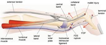 Approximately 1 cm of the distal fdp tendon is preserved. Finger Tips Tendons And Ligaments