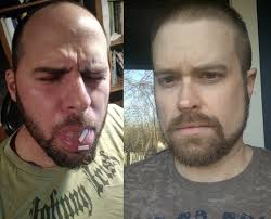 Cheddar Mane” and “Hardmous”: St Louis area Bowl Patrol