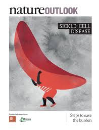 What causes sickle cell anemia. Nature Outlook Sickle Cell Disease