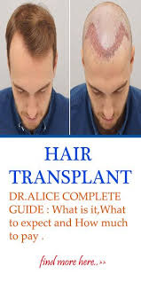 Almost All Surgery Specialists Now Are Performing A Hair Transplant Surgery This Will Get Rid Of The Unusual Types Of Plastic Surgery Plastic Surgery Surgery