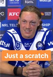 Rugby League: Just a Scratch Interview Moments