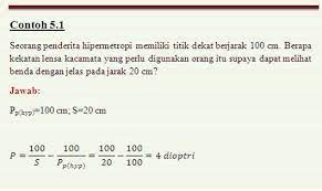 Hipermetropi atau hiperopia atau rabun dekat adalah kelainan refraksi mata di mana bayangan dari sinar yang masuk ke mata jatuh di belakang retina.hal ini dapat disebabkan karena bola mata yang terlalu pendek atau kelengkungan kornea yang kecil. A Mata Fisika Memang Asyik