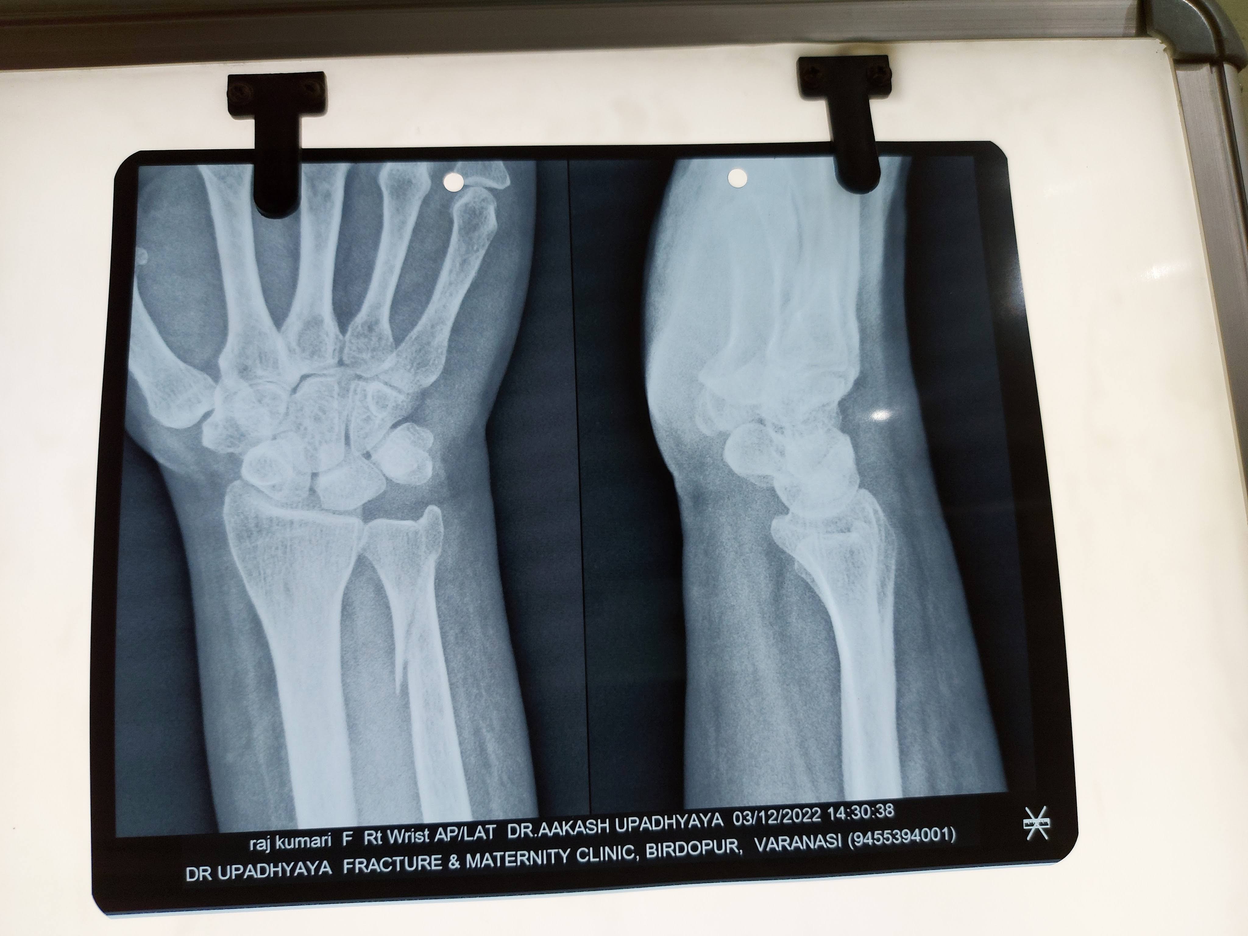 X-Ray product image