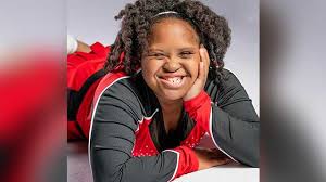 The result is 21 photos and short bios that provide a beautiful testimony to the global reach of down syndrome, as well as the tremendous diversity among people with down syndrome. Oklahoma Teen With Down Syndrome Selected For Be Beautiful Be You Fashion Show