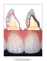We did not find results for: Pdf Optical Behavior Of Current Ceramic System
