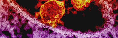 Adjust the presentation of the statistic and data points. Coronavirus Covid 19 An Update On The Law As Scotland Moves To Phase 2 Spice Spotlight Solas Air Spice