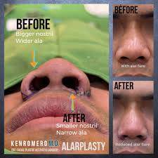 Dr. Ken Romero ENT FACE MD