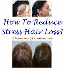 Pin On Hair Loss Treatment