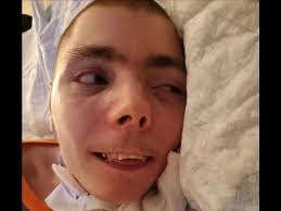 Fundraiser for Stephanie Webster by Chris Hoffman : Freedom for Bradley,  Handicap Van & Ramp Desperately Needed