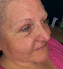 Nose piercing model needed today at 1:30