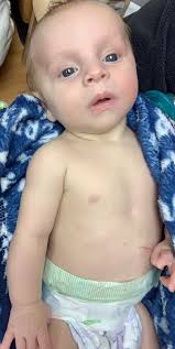 support for bubba and his family