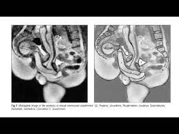 Improbable Research Collection #119: MRI Sex - YouTube