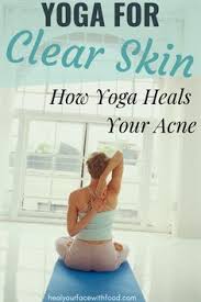 Yoga Acne What You Need To Know Heal Your Face With Food In 2020 Skin Care Solutions Face Yoga Yoga Poses