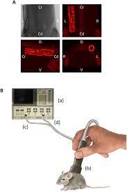 If a metal object passes through the metal detector, the pulse creates an opposite magnetic field in the object. Ex Vivo Assessment And In Vivo Validation Of Non Invasive Stent Monitoring Techniques Based On Microwave Spectrometry Scientific Reports