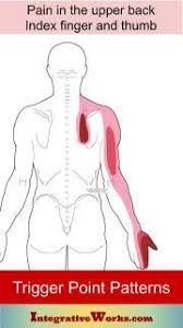 Pin On Torso Into Arm Trigger Point Pain