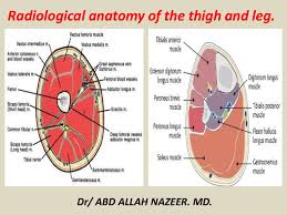 The muscles in the upper leg power many of our movements. Presentation1 Pptx Radiological Anatomy Of The Thigh And Leg