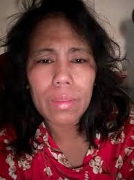 I was just discharged from the hospital a few nights ago and am still  having tremendous hardship from sinus procedures. The pollen was very high  today when I went to a doctor