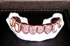 Hip hop grillz for women can be sleek and subtle. Amanda Bynes Rose Gold And Diamond Grill Goes Unclaimed Racked