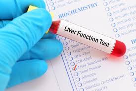 Image result for Liver Function Test