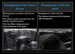 Pin By Tnfri On Sonography Sonography Radiology Ultrasound